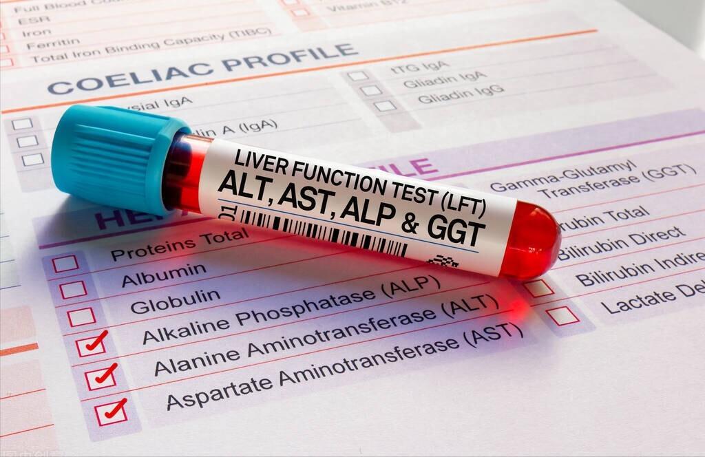 降酶保肝药短期内能降低转氨酶吗,慢性乙型肝炎保肝降酶药有哪些