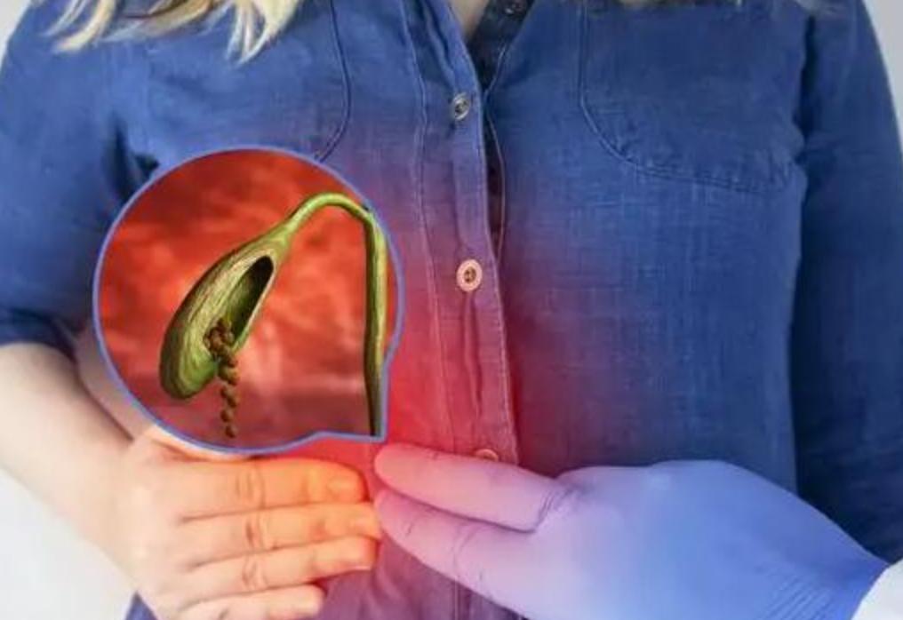 胆囊出现问题身体会出现哪些症状,人没了胆会有哪些症状