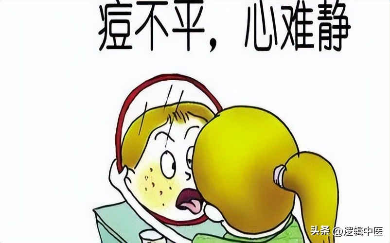 脸上的痘痘一直很红,脸上的痘痘一定要挤掉吗