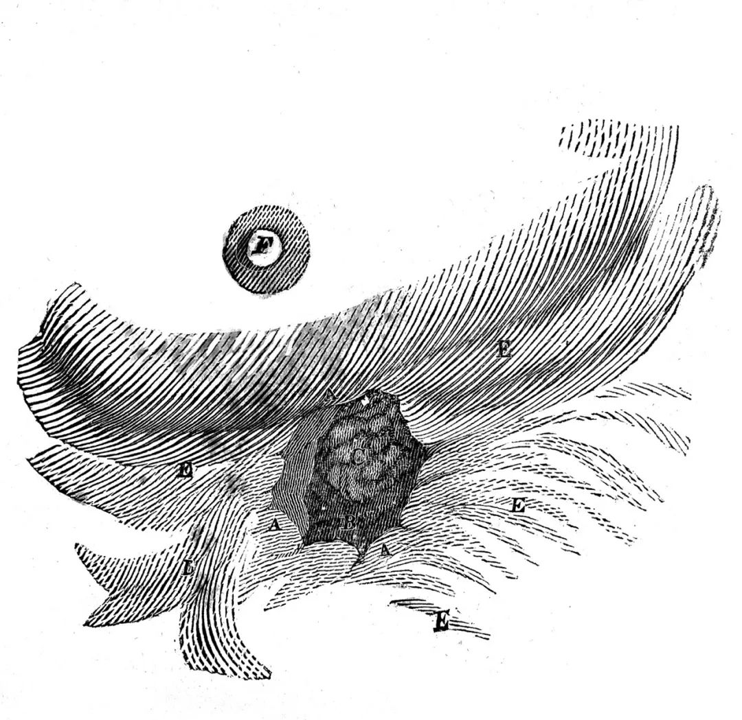 胃部开洞58年，一个普通人的痛苦如何成就消化系统生理学？