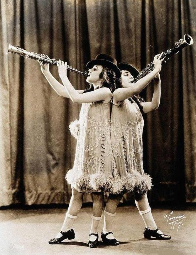 英国连体双胞胎姐妹,英国连体姐妹