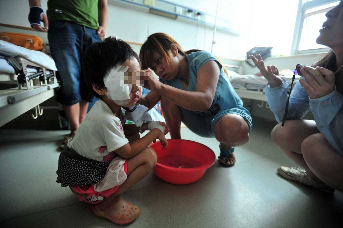 女儿被同学抓伤对方家长理直气壮,孩子脸被同学划伤怎么协商赔付