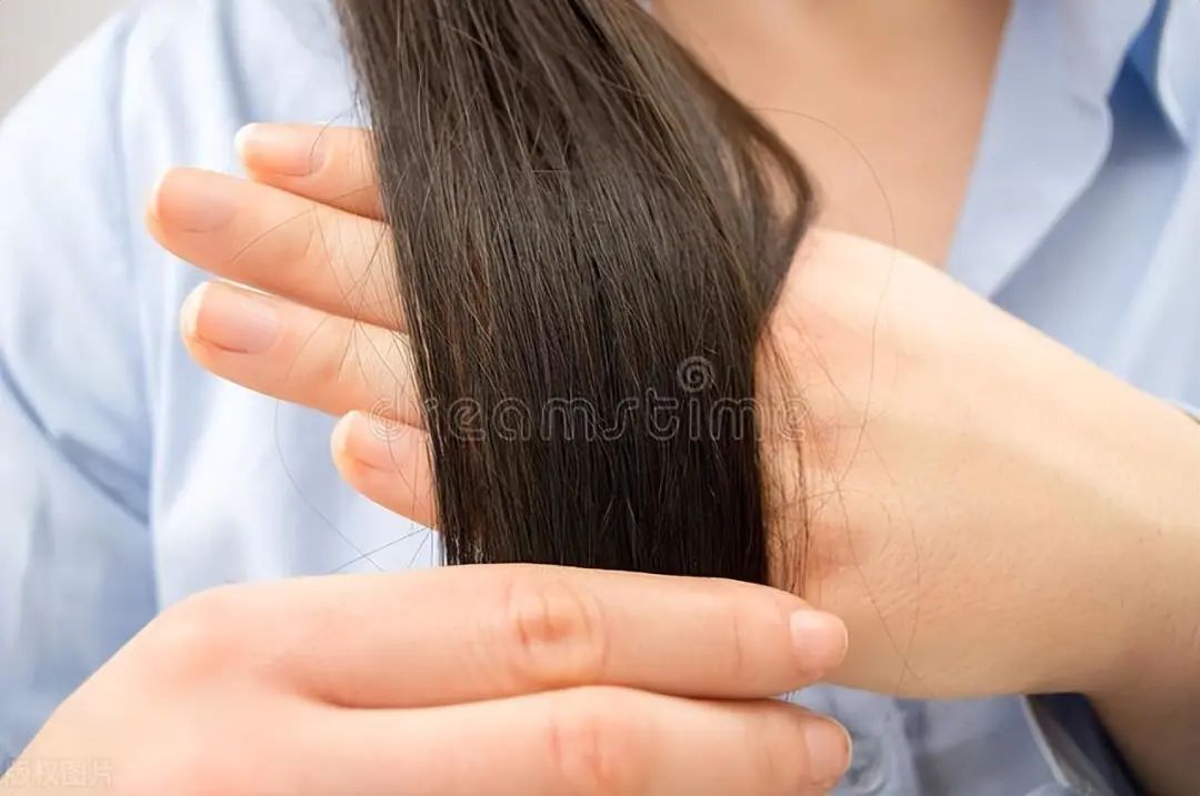 染完头发头皮头屑大块怎么处理,染头膏染完头发很痒有头屑怎么办