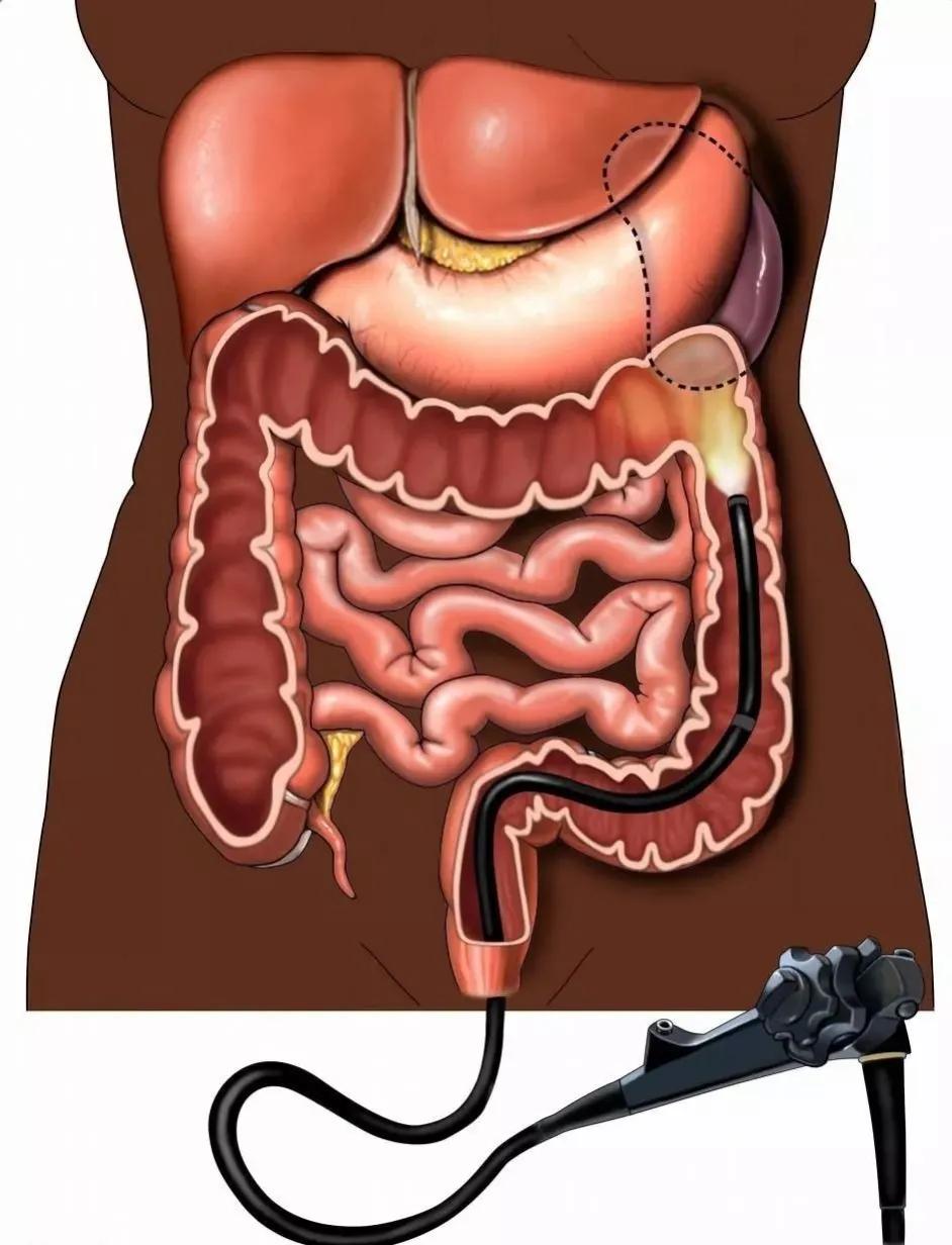 如果不能改变现状就换个活法,如果不能改变现状那就努力的活着