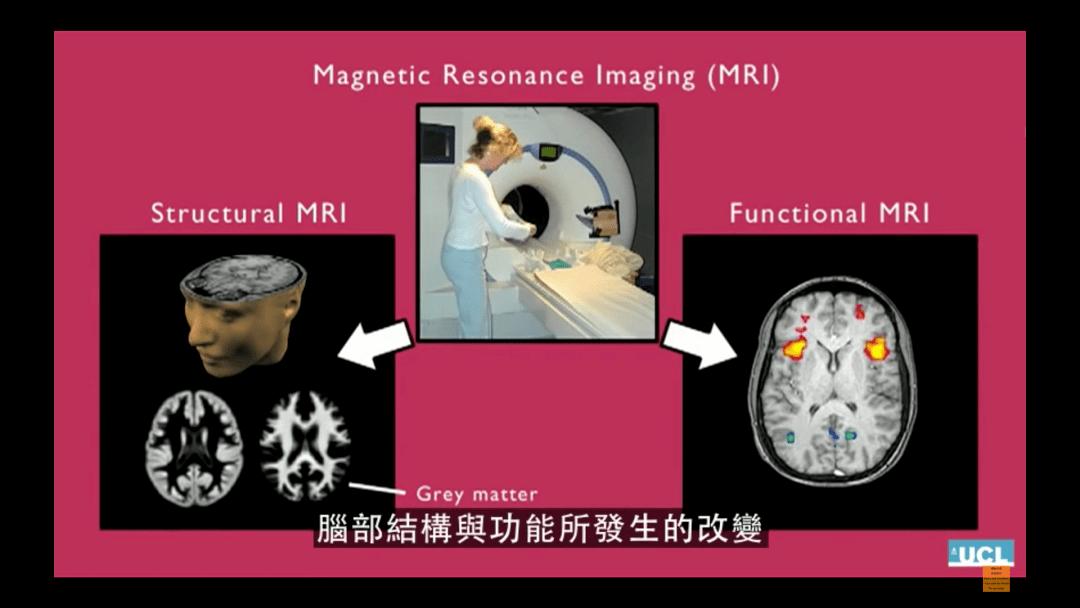 如何应对青春期的孩子倔强,青春期叛逆的孩子怎样快速度过呢