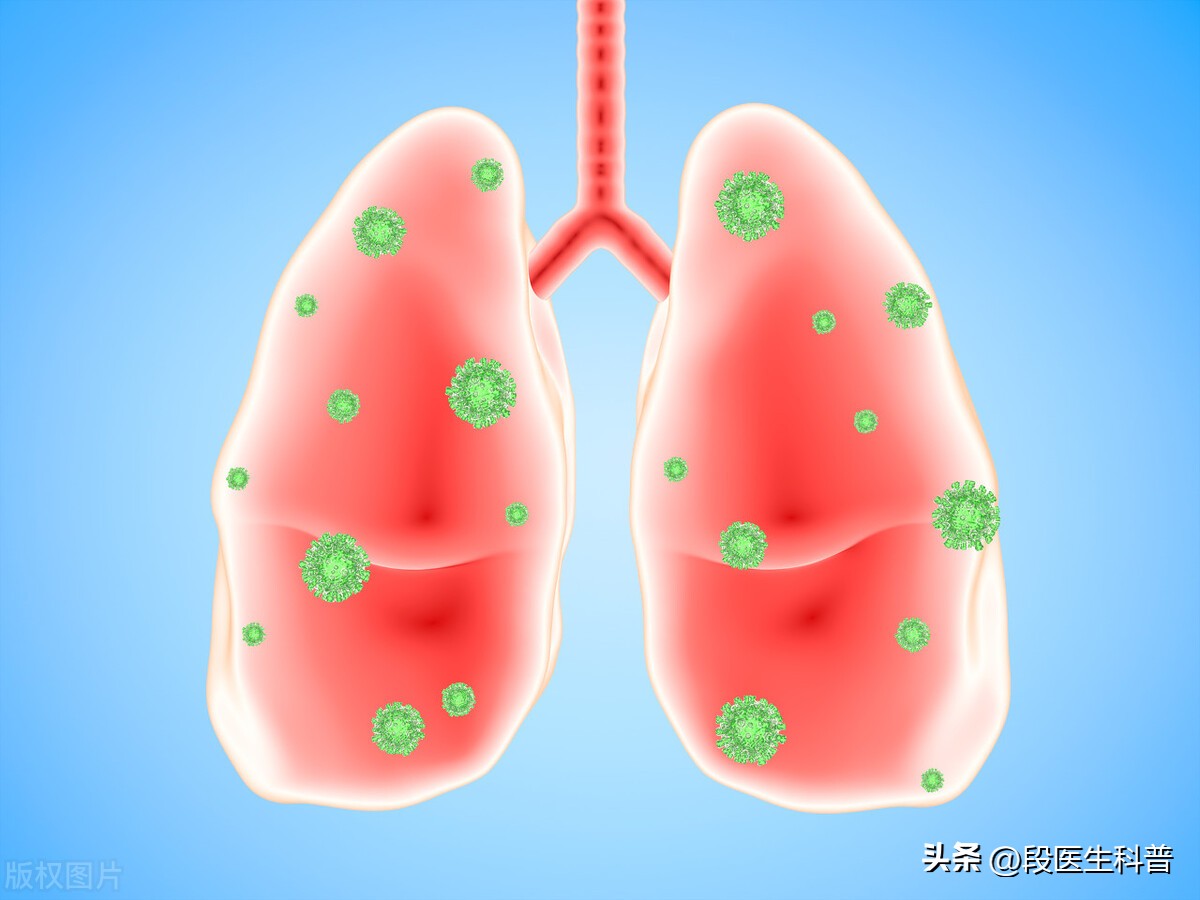 肺炎危害程度有多大,肺炎一般需要多久才能彻底治愈