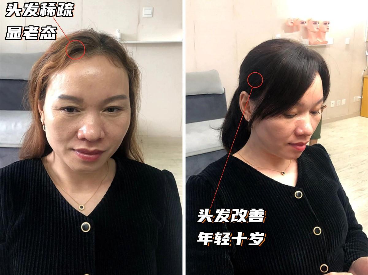 年纪大了为什么头发稀疏了,随着年龄增长头发变稀疏正常吗