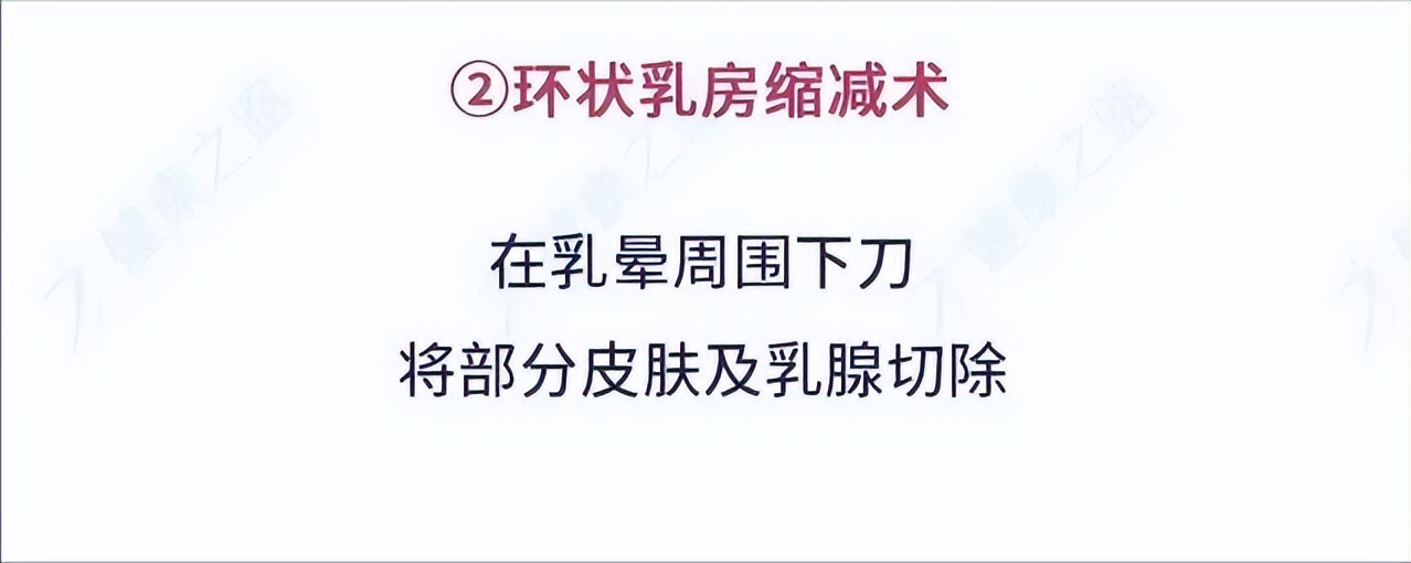 胸大好还是胸小比较健康,胸32a标准尺寸是小胸吗