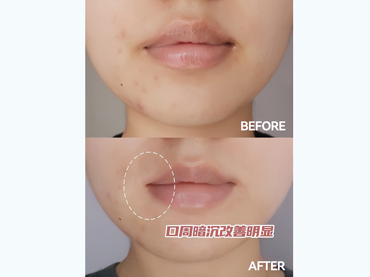 onlylady美容天后排行,2021onlylady年度新锐洁面大奖