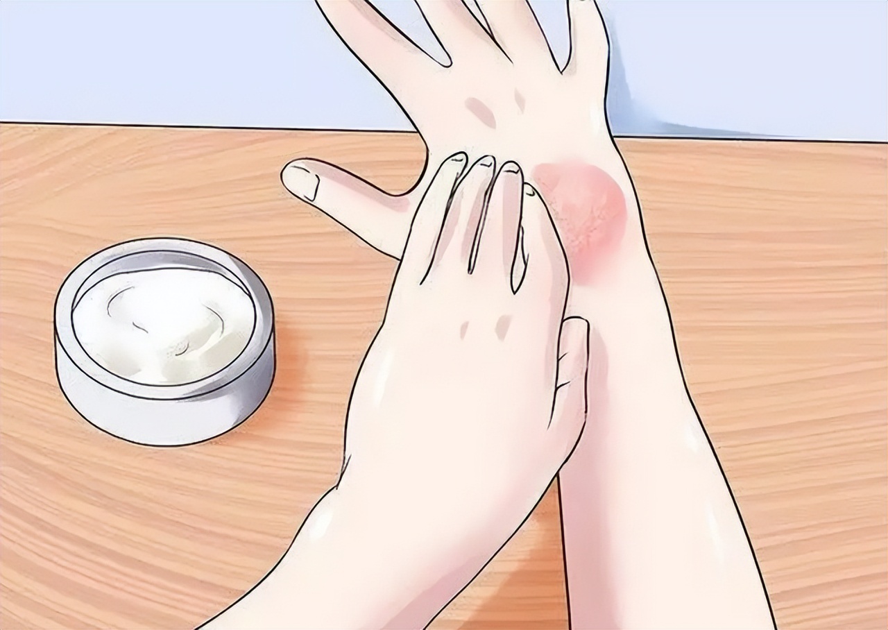 头皮长疙瘩和脓包是什么原因,头皮上经常长脓包是怎么回事