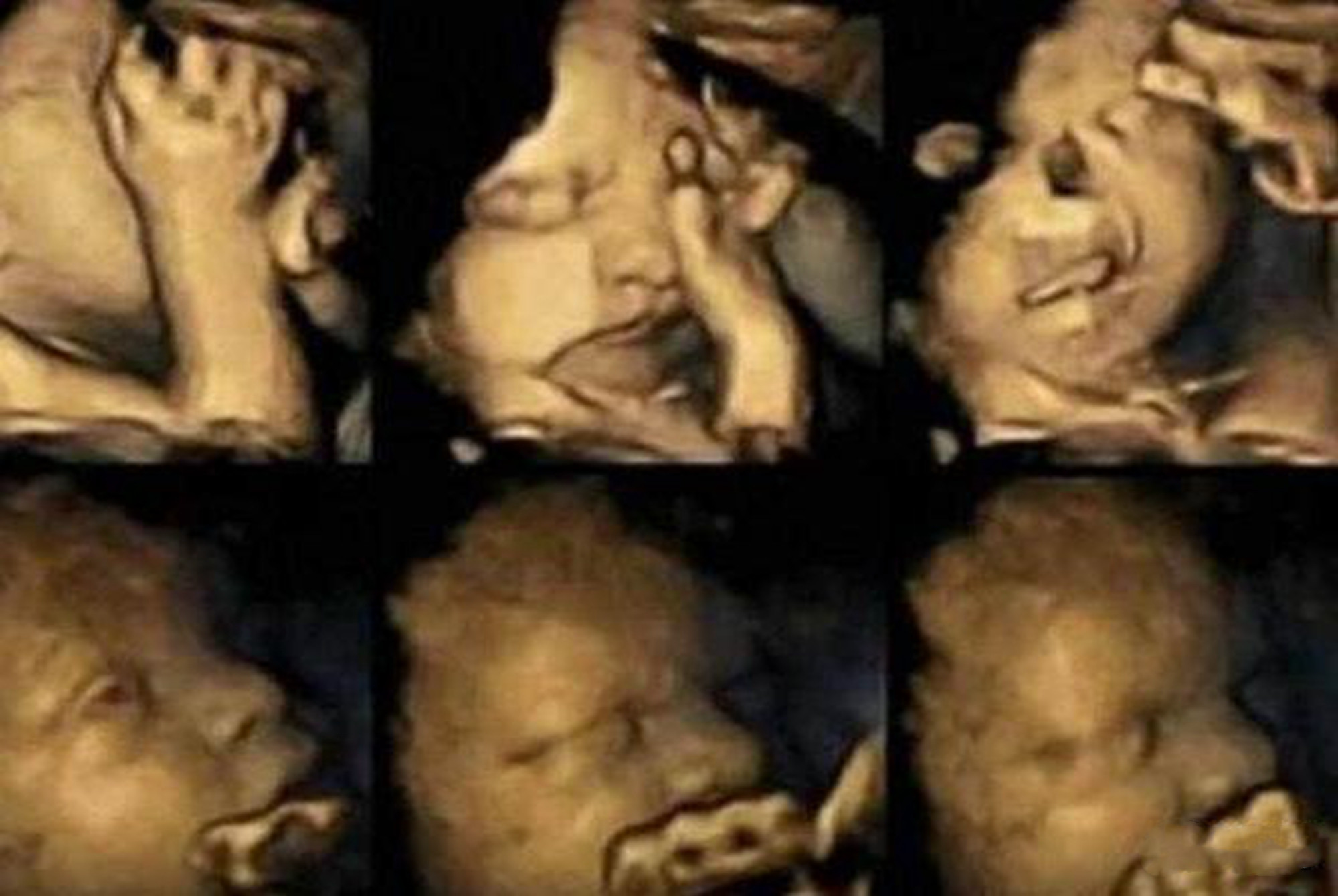 二胎宝妈完全不想带娃怎么办,为什么现在宝妈不愿意产检