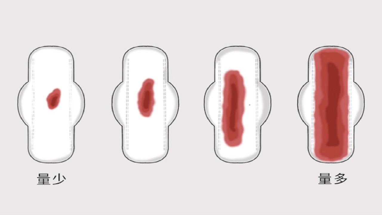 为什么日本女性妇科病发病率低,为何日本女性很少患妇科病