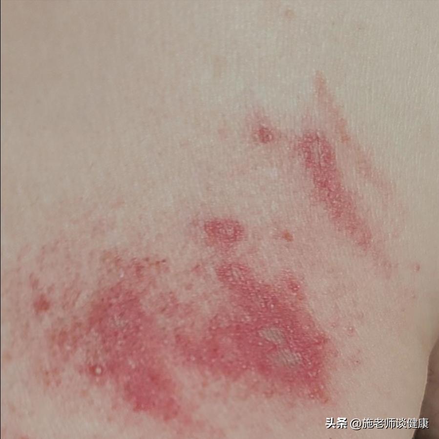 常见的虫子有哪些不能用手拍,上热搜遇到这种虫子千万别用手拍