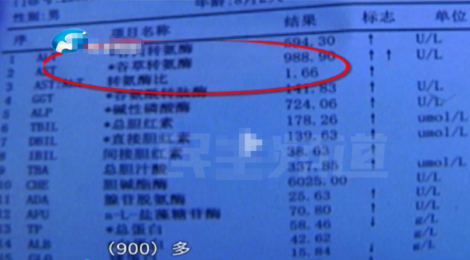 孩子把感冒药吃多咋办,小孩感冒吃错药肝衰竭