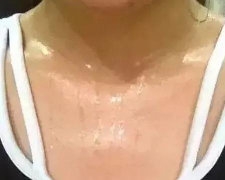 经常爱出汗是什么原因,经常爱出汗是什么问题