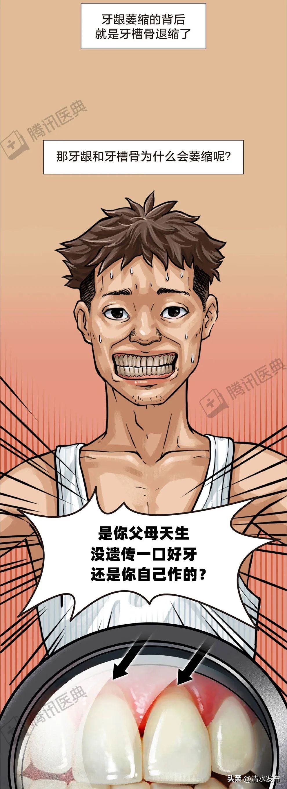 两边大牙一吃肉就塞牙如何修复,14岁学生吃肉老是塞牙需要矫正吗