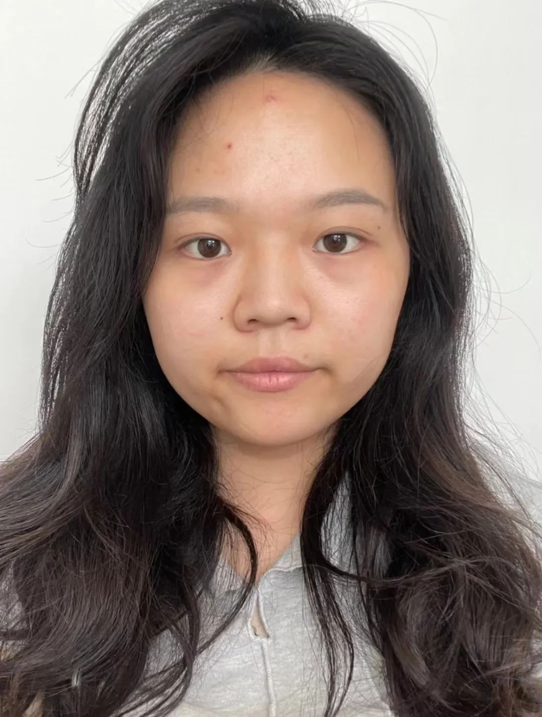 塌鼻子正脸好看,塌鼻子该如何变美啊