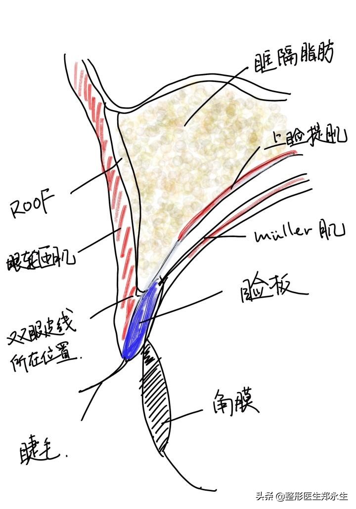 眼袋大最好的去眼袋的方法,眼袋大的原因和去眼袋方法