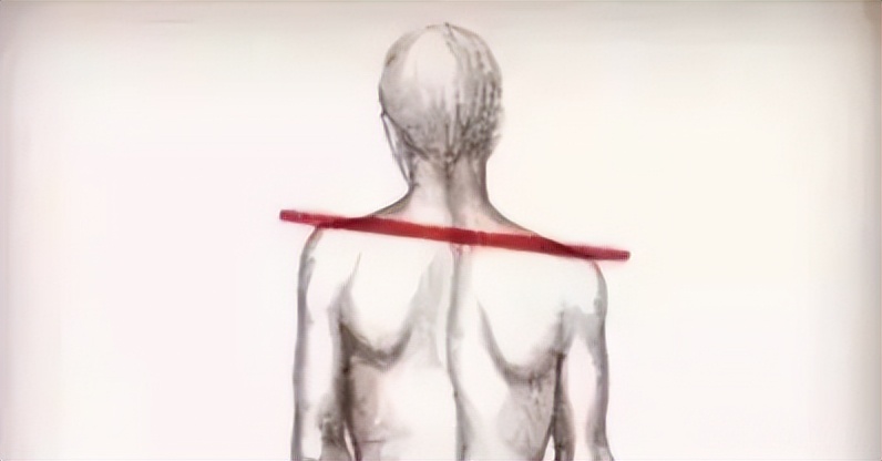 高低肩的最佳矫正方法,高低肩手法纠正视频