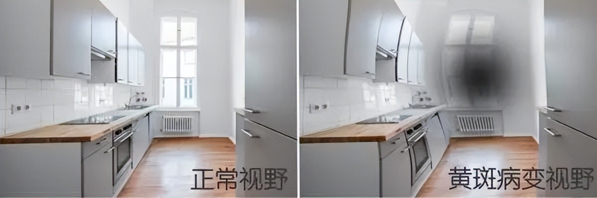 视百年可以治视神经萎缩吗,视百年眼科怎样