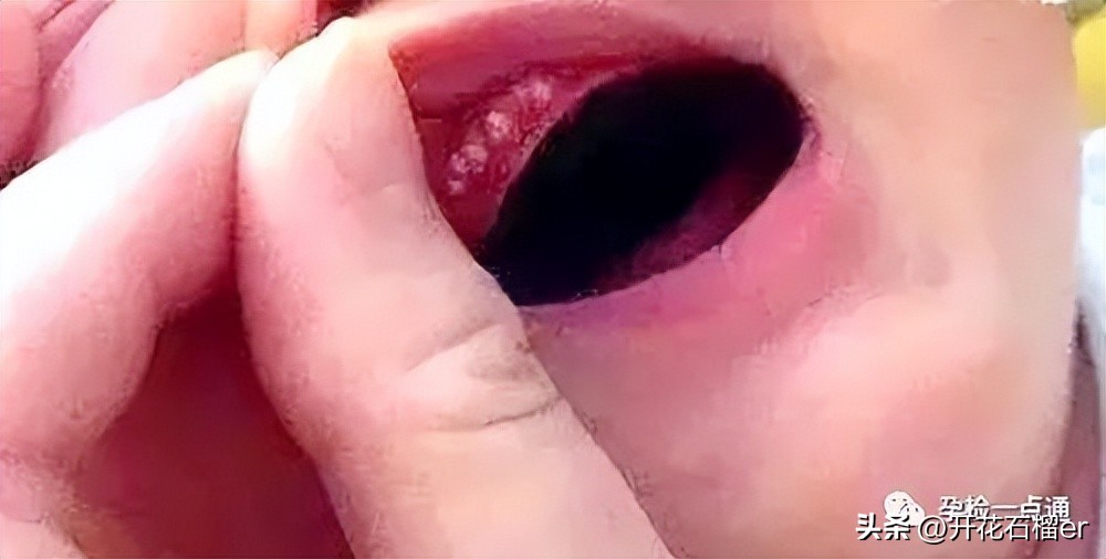 新生儿这5大状况你最担心哪个,新生儿有些表现不用治您知道吗