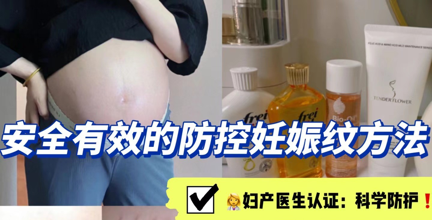 孕期预防妊娠纹小妙招,孕妇怎么防妊娠纹用什么