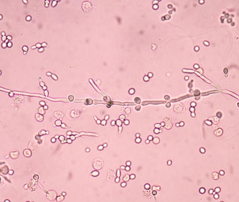 不起眼的五个行为正在毁掉你的肾,6个不起眼的习惯正在伤害眼睛