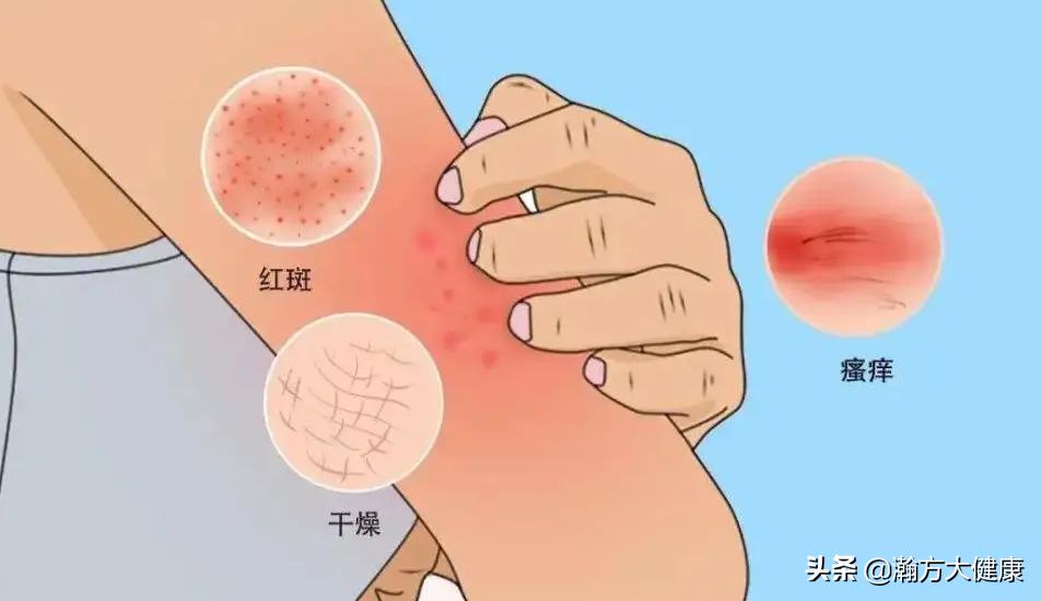 止痒地肤子,消风止痒药膏的作用