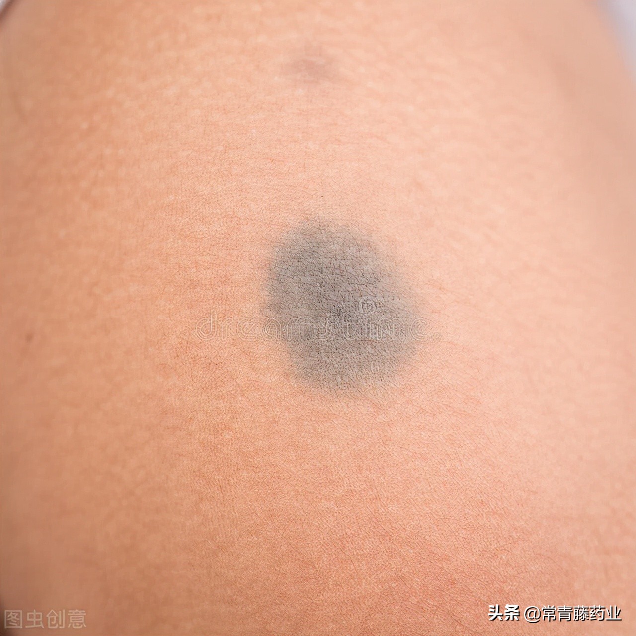 你有皮肤黑粗暗黄的烦恼吗,你有斑的烦恼吗