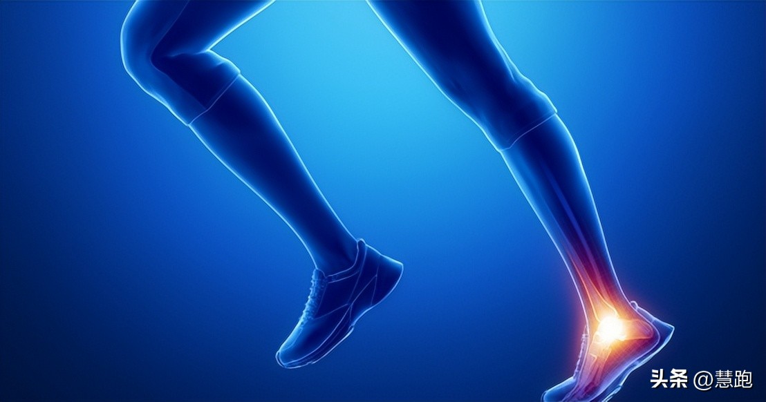 这类顽固性的跑步伤痛最让跑者头疼：4种有效康复方法教你破解