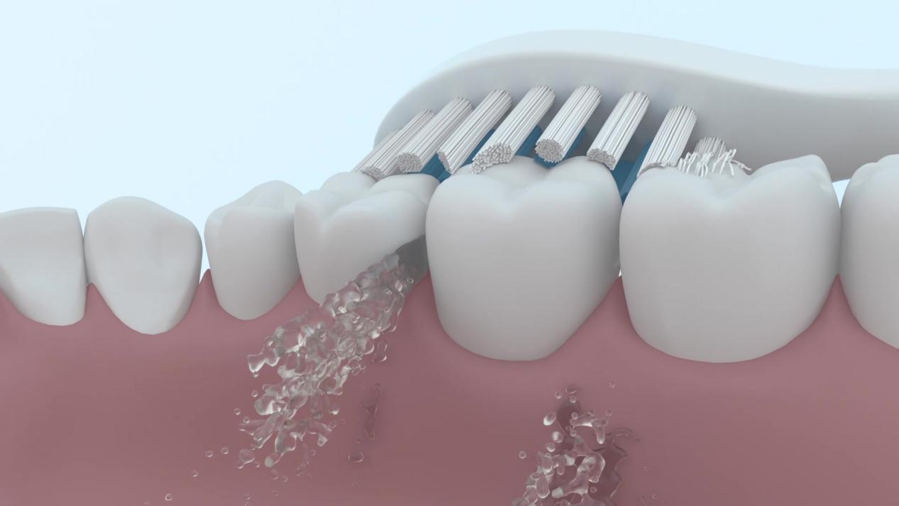 牙医电动牙刷的正确使用方法,电动牙刷怎么用不伤牙齿