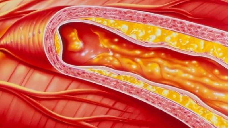 花生是心血管病的克星还是营养品,花生是心血管的祸根还是福音