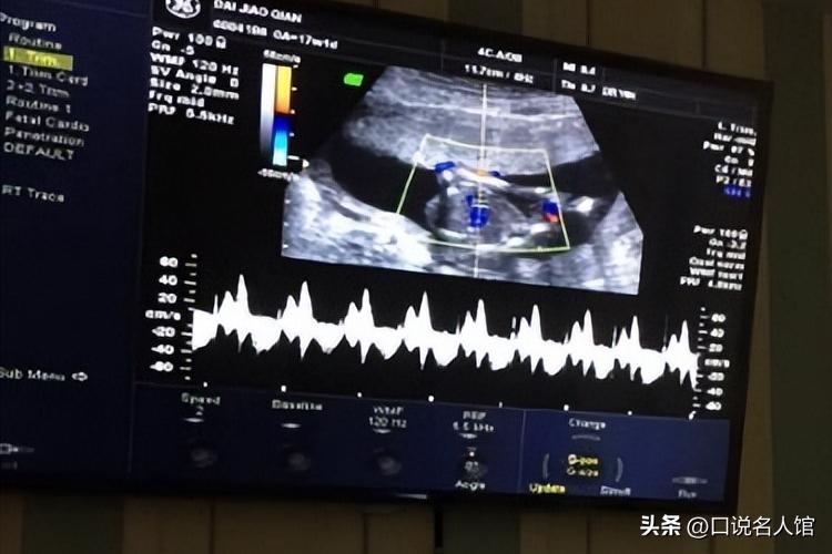 女子备孕十年没动静,备孕三年去医院检查医生说快生了