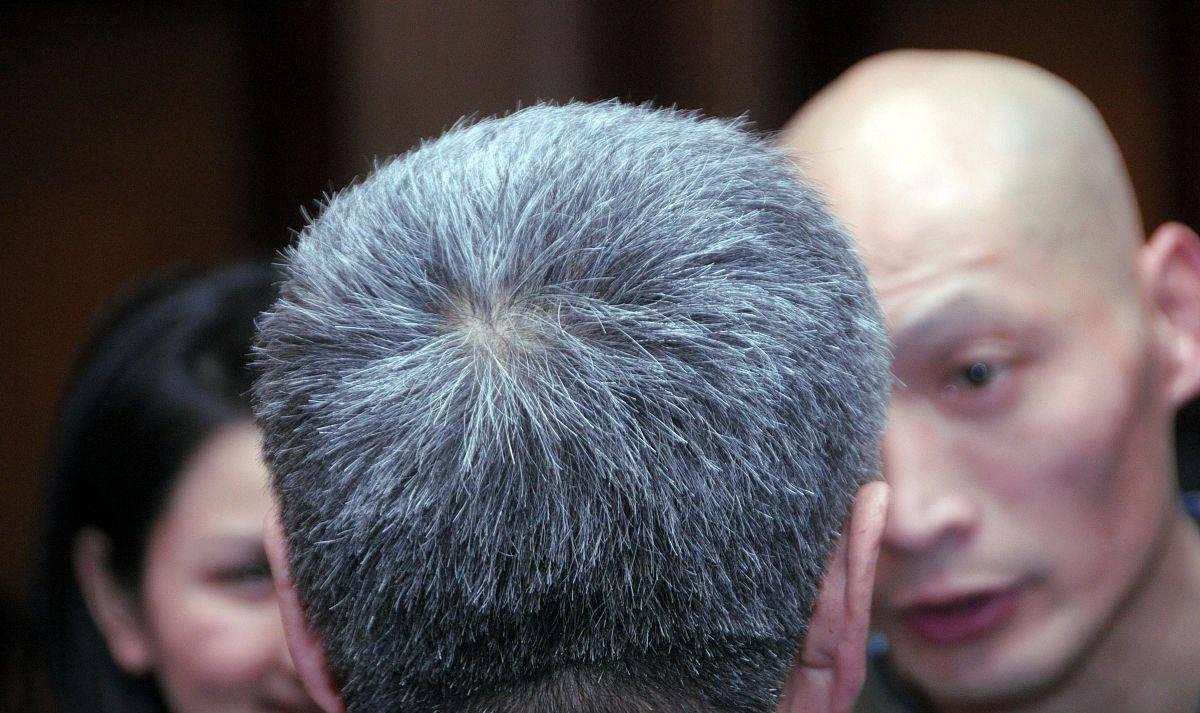 白发长在前面两侧后脑勺代表什么,白发长在正头顶代表身体哪个器官