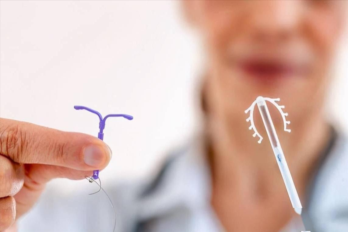 女性“上环”的全过程，会不会伤害女性健康？男女都要好好看看！