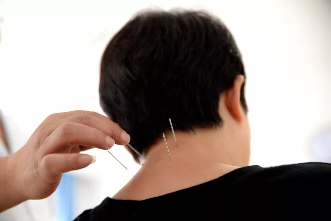 针灸临床经验选编精华,古法针灸临床治验