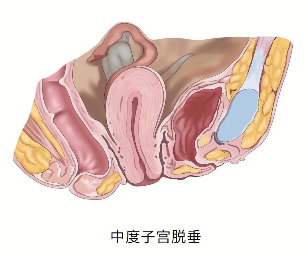 女性到了夜晚放屁多怎么回事,女性到了夜晚放屁多响怎么回事