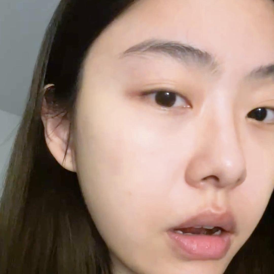 你们一直问我do脸恢复期要怎么做!都用什么!#美商