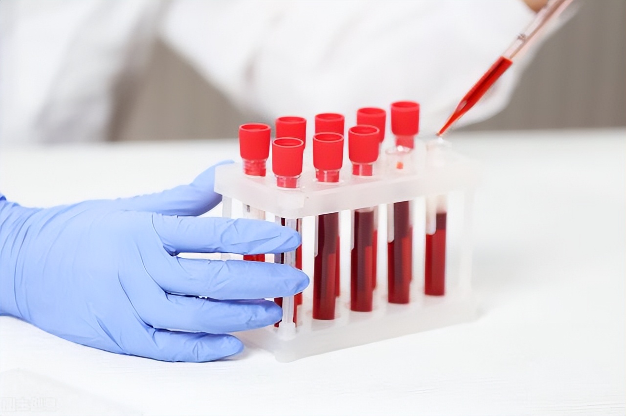 糖尿病肾病几期血肌酐会升高,血肌酐是不是升高后就无法下降了