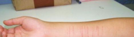 女孩被迫纹纹身,女人被迫纹身手术