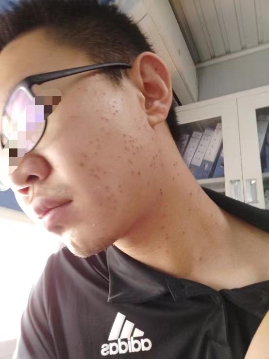 添悦脱毛仪黑榜,添悦脱毛仪事件