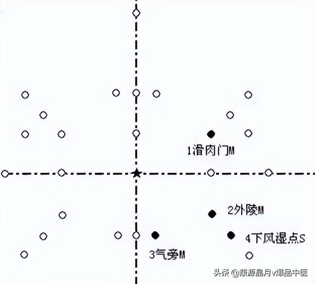 腹针疗法及16例常用处方