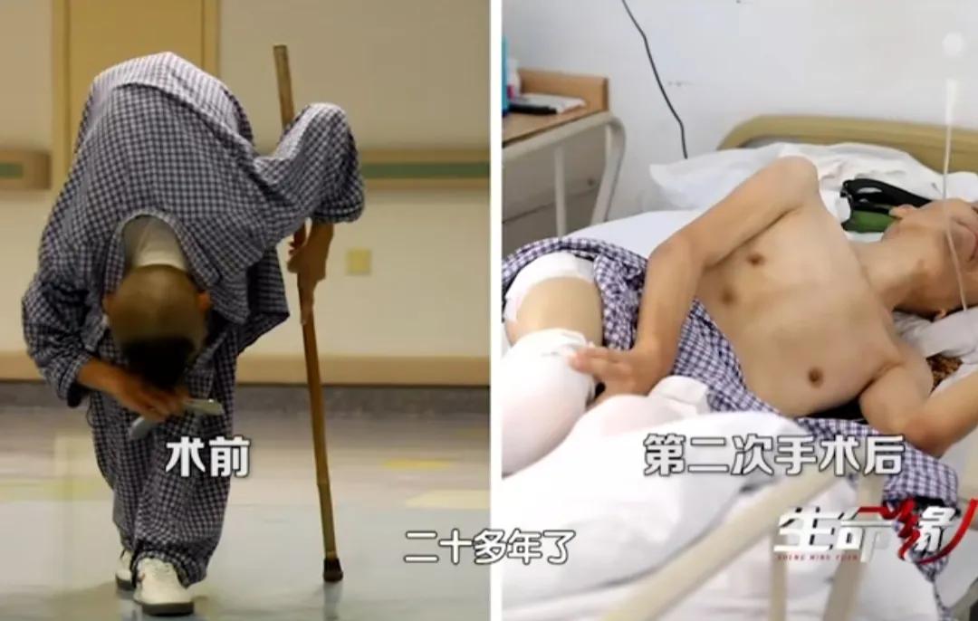 我，这把*刀折**，折叠了26年的身体被重新打开