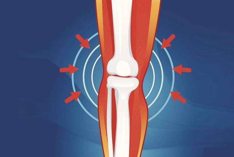 关节咔咔响是什么原因引起的,关节咔咔响是什么意思