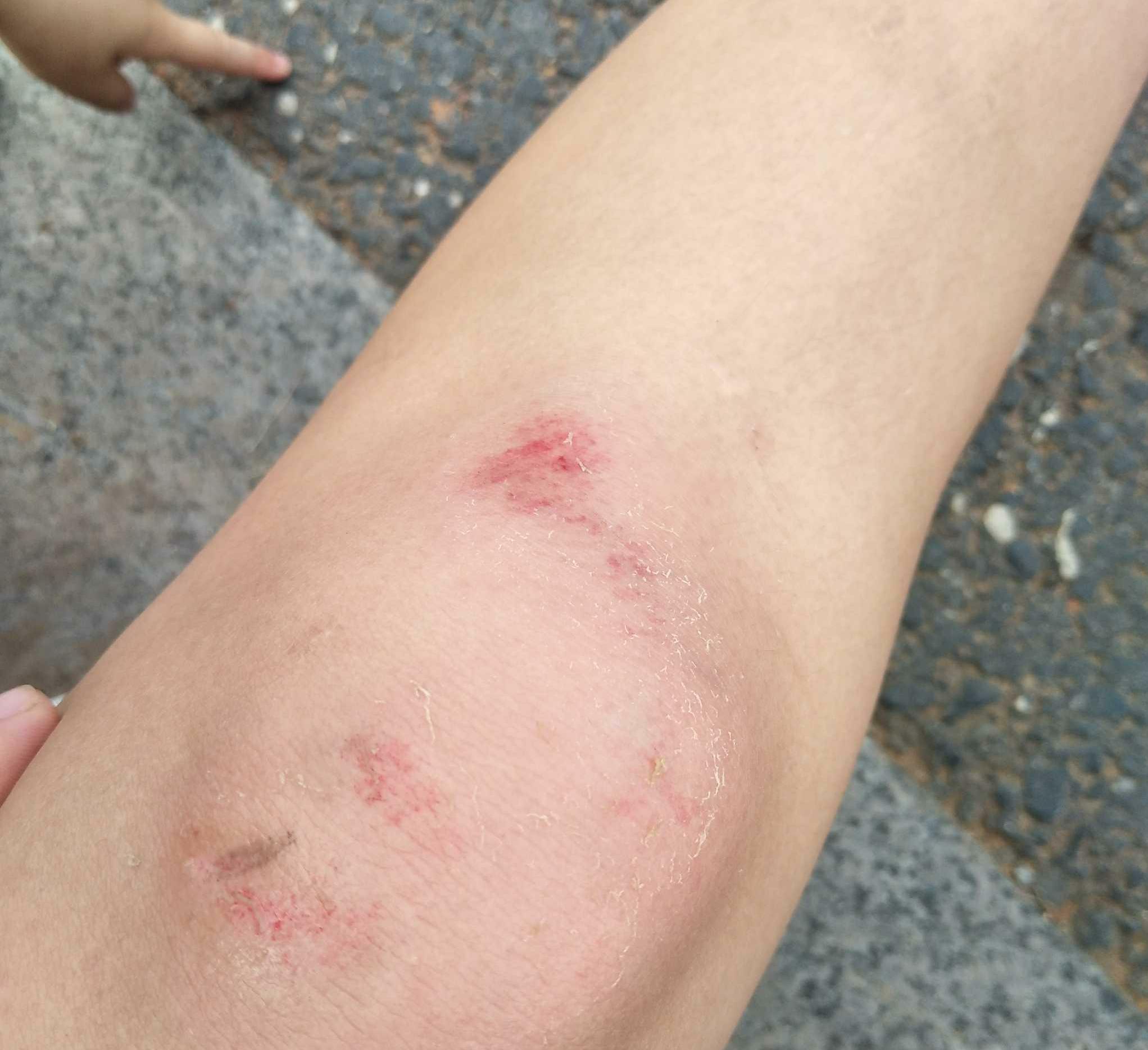 我还是没有逃过骑行必然会摔跤的魔咒