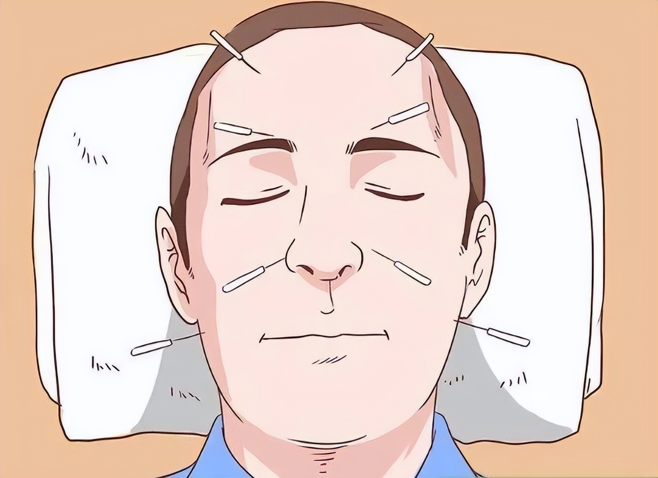 表情不受管理怎么办,表情不受控制是什么病