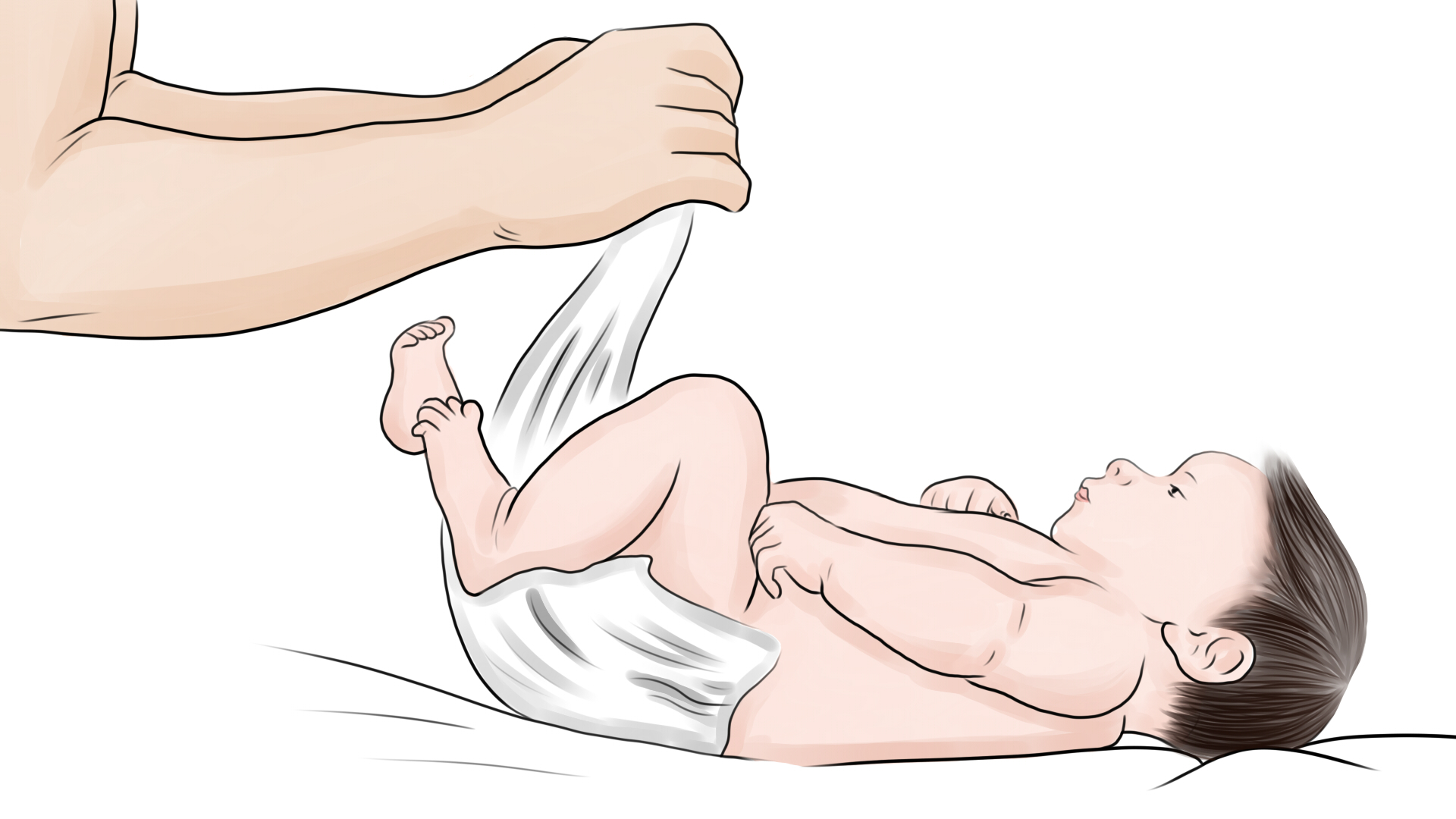 霉菌性阴道炎的基本常识都有哪些,女幼童阴道炎自己能好吗