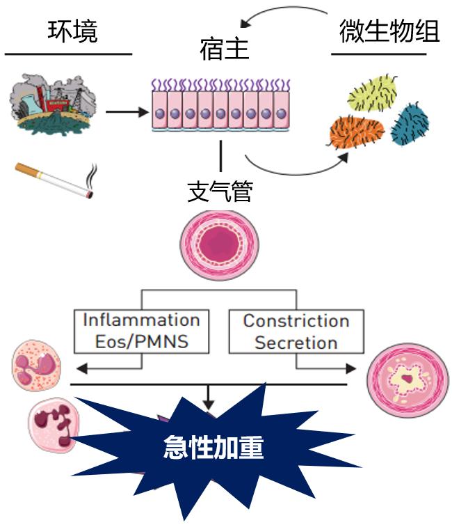 周敏教授：慢阻肺病、支扩及慢阻肺支扩重叠综合征气道微生物研究