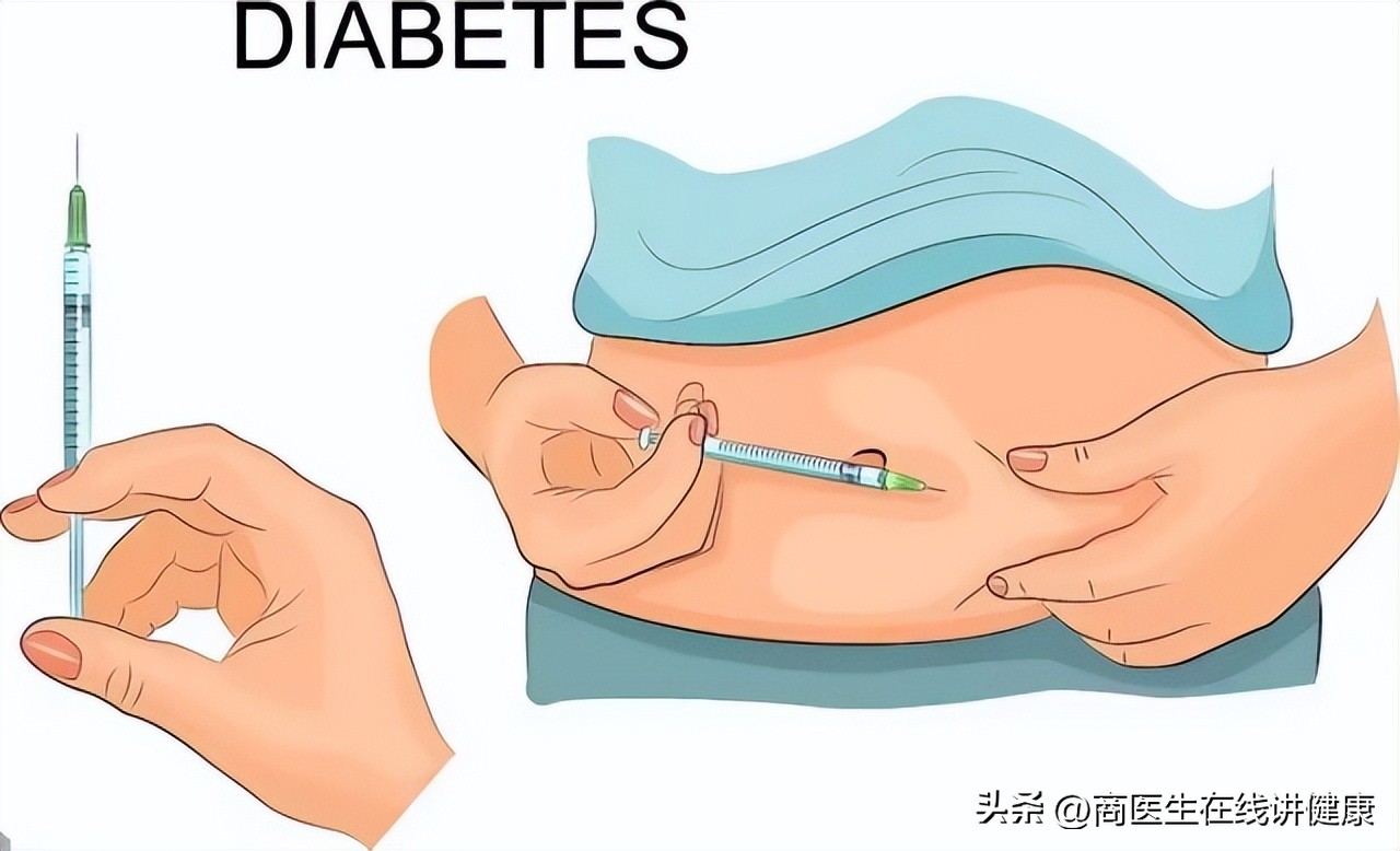 降糖药达格列净长期吃有什么害处,降糖药物达格列净有什么优势