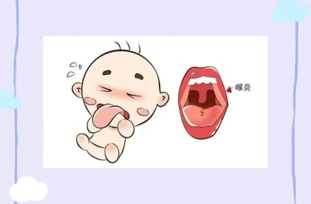 小儿喉炎声音嘶哑视频,孩子夜里突然咳嗽是急性喉炎吗